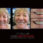 Vogue Smiles Melbourne - Vogue Dentist - Vogue Dental Melbourne -Best Cosmetic dentist in Melbourne CBD