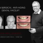 Vogue Smiles Melbourne - Vogue Dentist - Vogue Dental Melbourne -Best Cosmetic dentist in Melbourne CBD