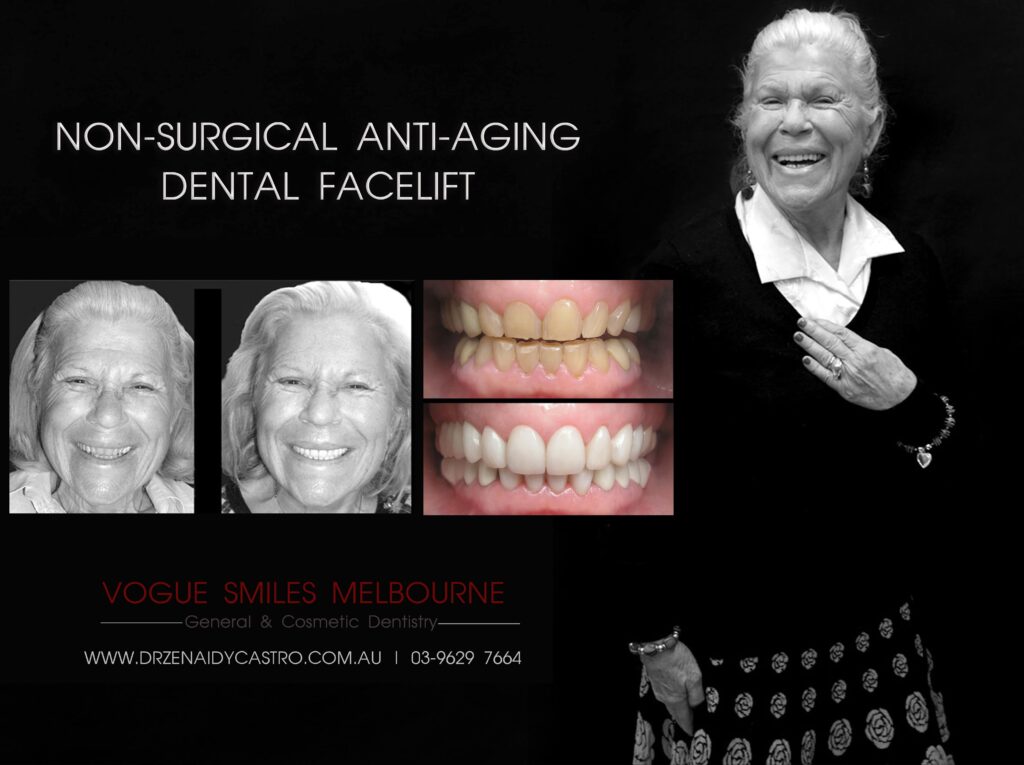 Vogue Smiles Melbourne - Vogue Dentist - Vogue Dental Melbourne -Best Cosmetic dentist in Melbourne CBD
