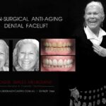 Vogue Smiles Melbourne - Vogue Dentist - Vogue Dental Melbourne -Best Cosmetic dentist in Melbourne CBD