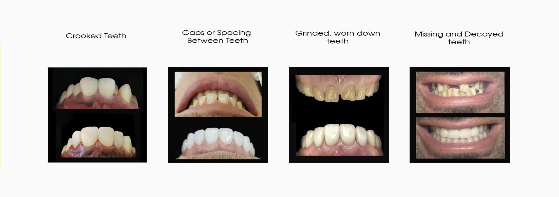 COSMETIC DENTIST IN MELBOURNE SMILE SOLUTIONS (1)