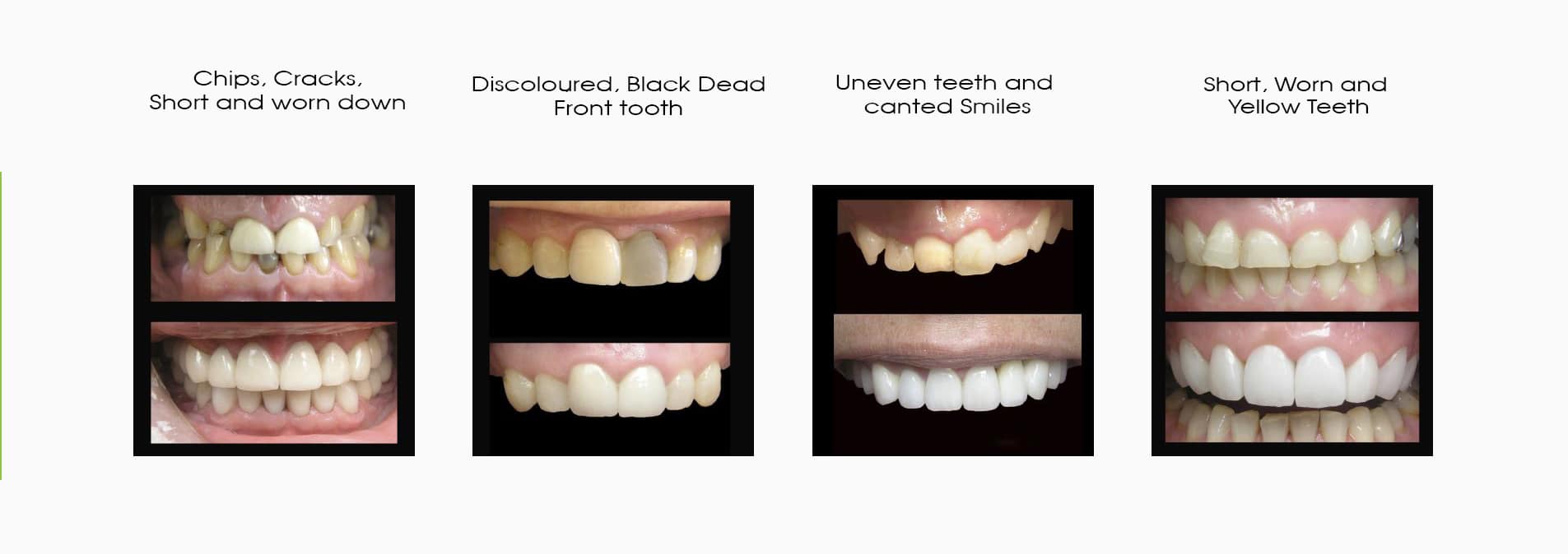 COSMETIC DENTIST IN MELBOURNE SMILE SOLUTIONS (2)