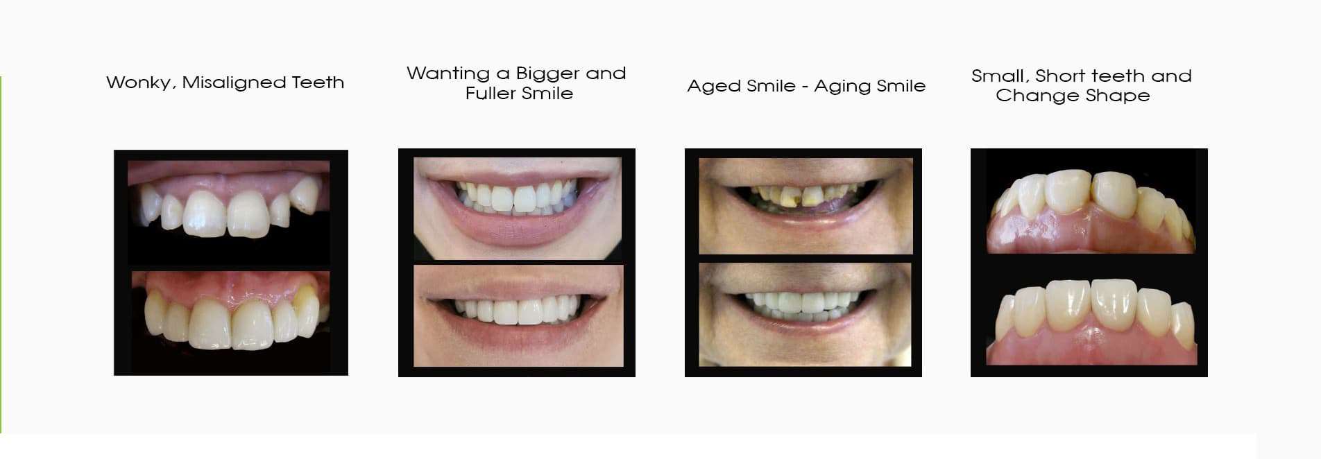 COSMETIC DENTIST IN MELBOURNE SMILE SOLUTIONS (3)