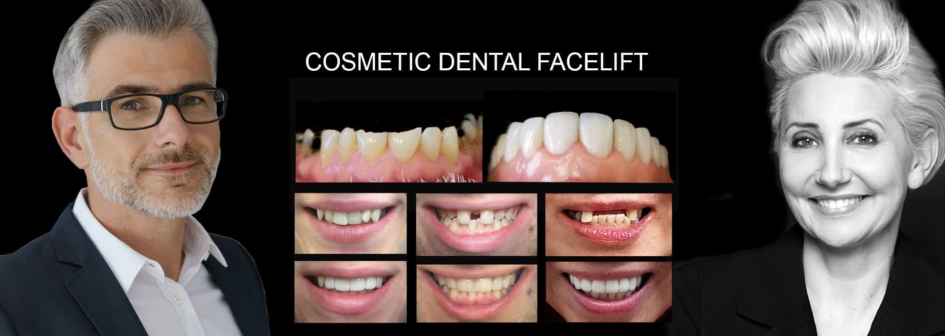 General & Cosmetic Dentist Melbourne - Before and After Smile Makeover Melbourne