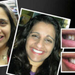 COSMETIC-DENTIST-IN-MELBOURNE-VOGUE-SMILES-MELBOURNE-2.jpg