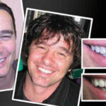 COSMETIC-DENTIST-IN-MELBOURNE-VOGUE-SMILES-MELBOURNE-3.jpg