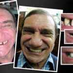 COSMETIC-DENTIST-IN-MELBOURNE-VOGUE-SMILES-MELBOURNE-4.jpg