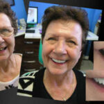 COSMETIC-DENTIST-IN-MELBOURNE-VOGUE-SMILES-MELBOURNE-5.jpg