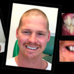 COSMETIC-DENTIST-IN-MELBOURNE-VOGUE-SMILES-MELBOURNE-7.jpg