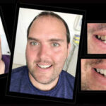 COSMETIC-DENTIST-IN-MELBOURNE-VOGUE-SMILES-MELBOURNE-8.jpg