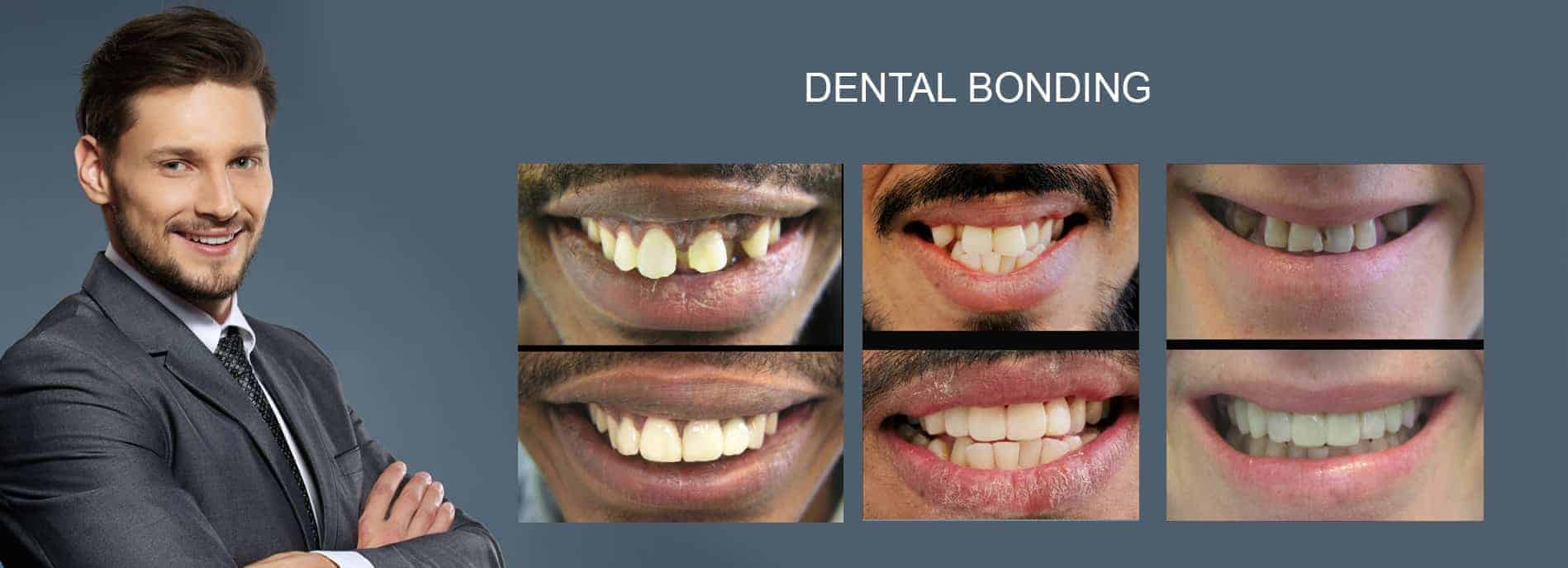 General & Cosmetic Dentist Melbourne - Before and After Smile Makeover Melbourne