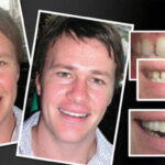 best-Cosmetic-Dentist-in-Melbourne-Before-and-After.jpg
